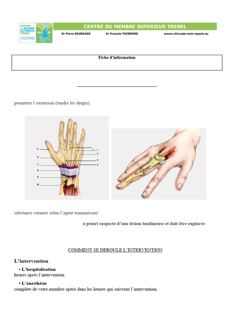 Plaies Des Tendons Extenseurs | PDF | Suture (médecine) | Main