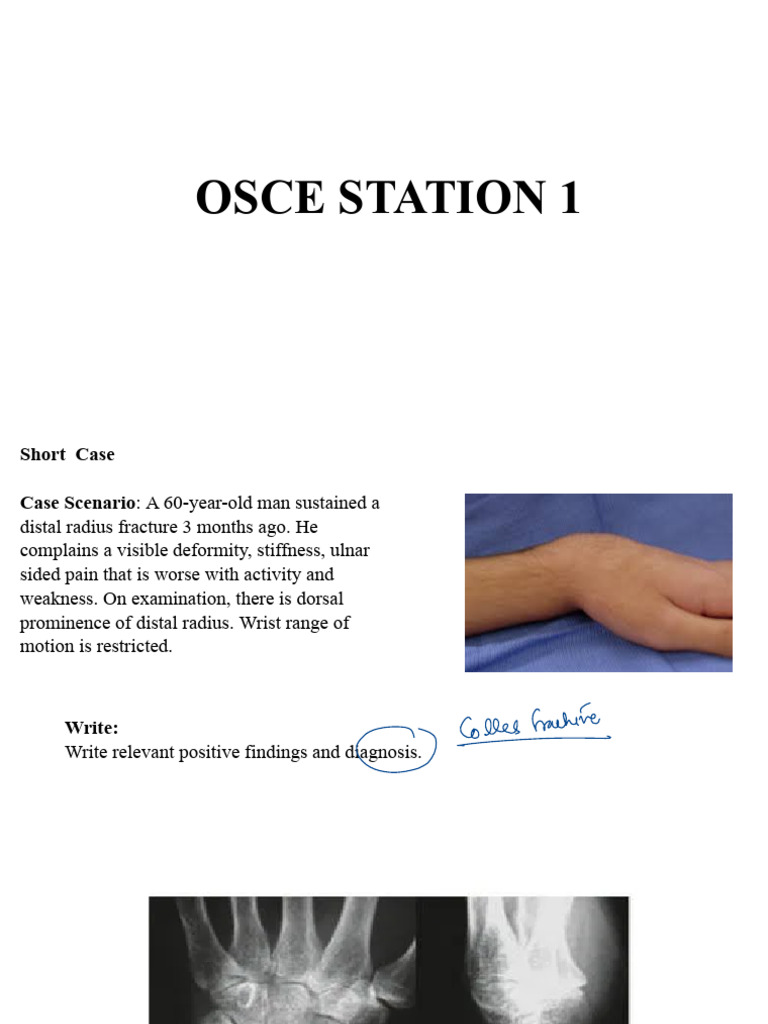ORTHO OSCE Cases For Practical Examination | PDF | Ischemia | Elbow