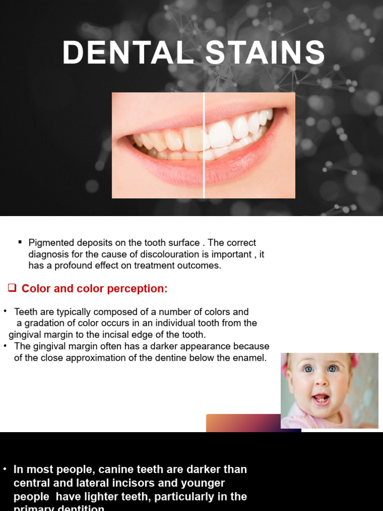 Dental Stain PDF | PDF | Tooth Enamel | Human Tooth