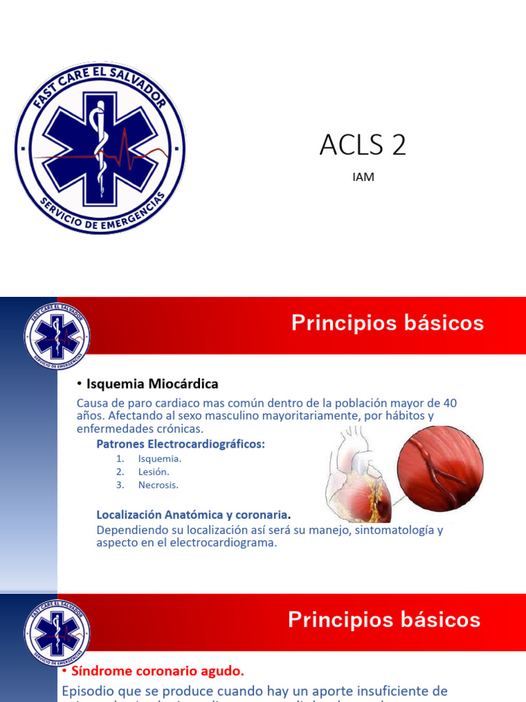 Sindromes Isquemicos Iam Acv | PDF | Infarto de miocardio | Isquemia