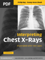 Chest X-ray Interpretation Masterclass | PDF
