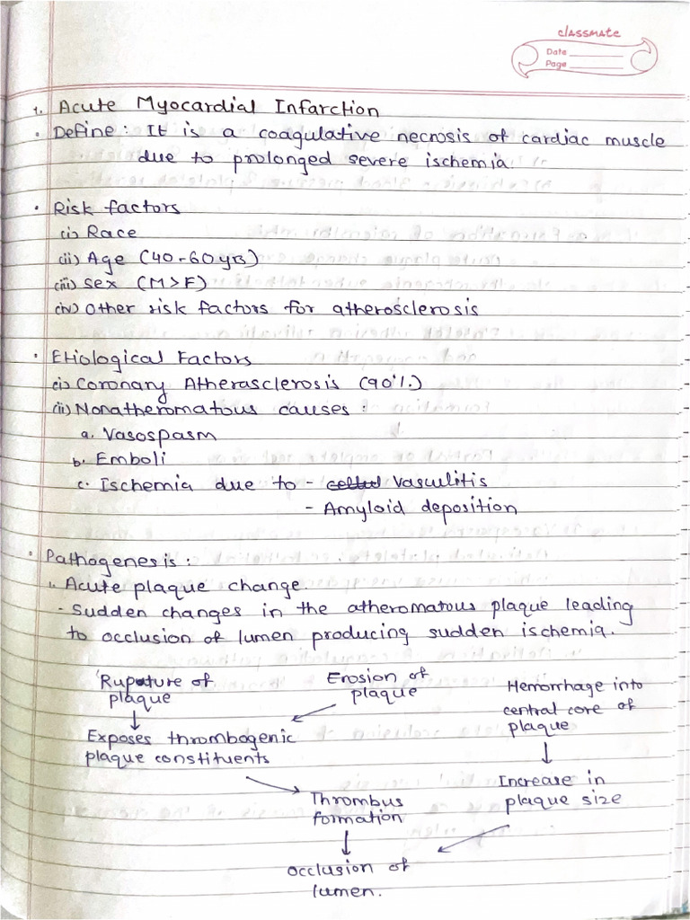Acute Myocardial Infarction | PDF