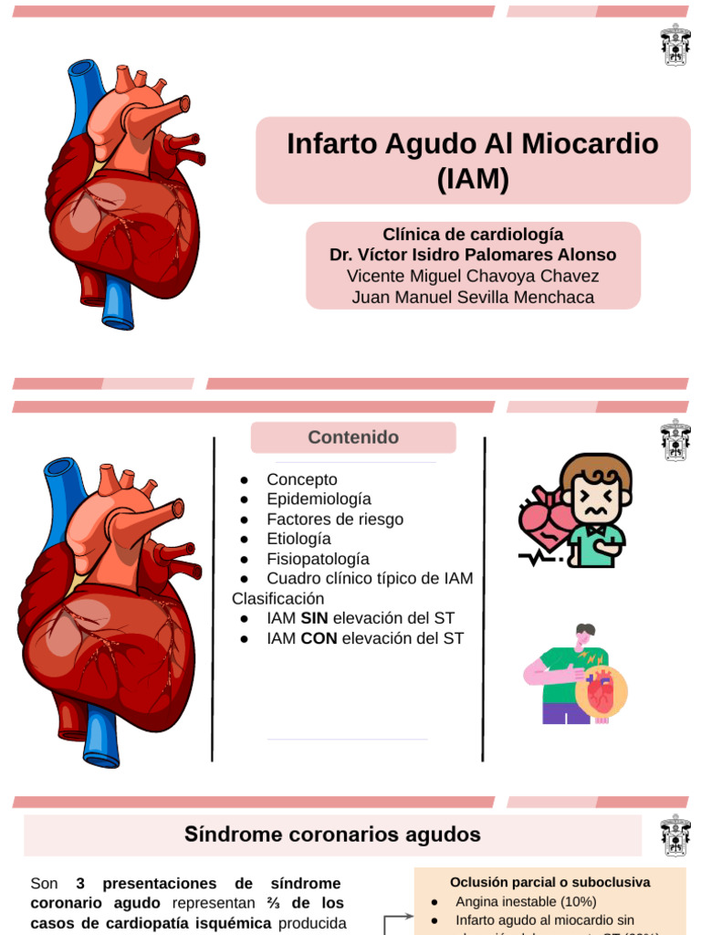 Infarto Agudo Al Miocardio | PDF | Infarto de miocardio | Isquemia