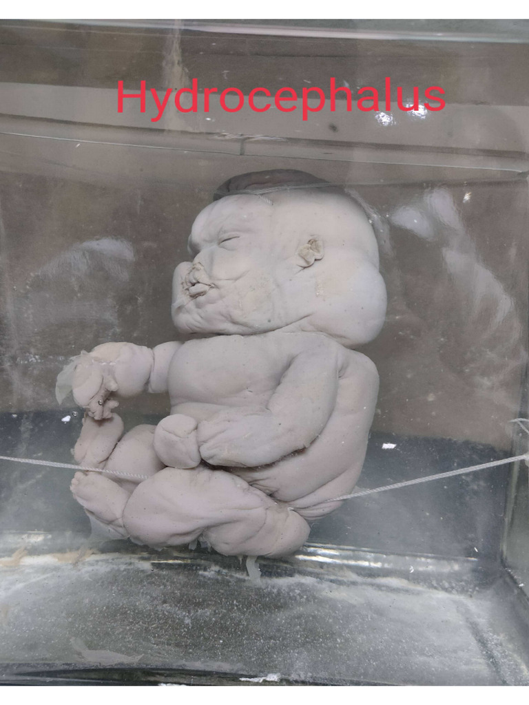 OBG Specimens | PDF