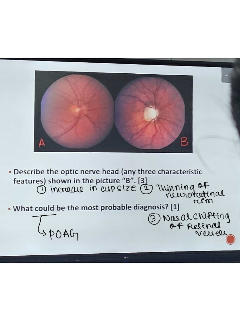 Opthalmology OSCE31.07.23 Part 2 | PDF