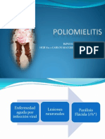 POLIOMIELITIS [Autoguardado]