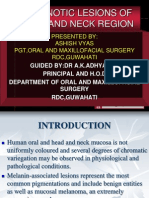 Melanotic Lesions of Head and Neck Region