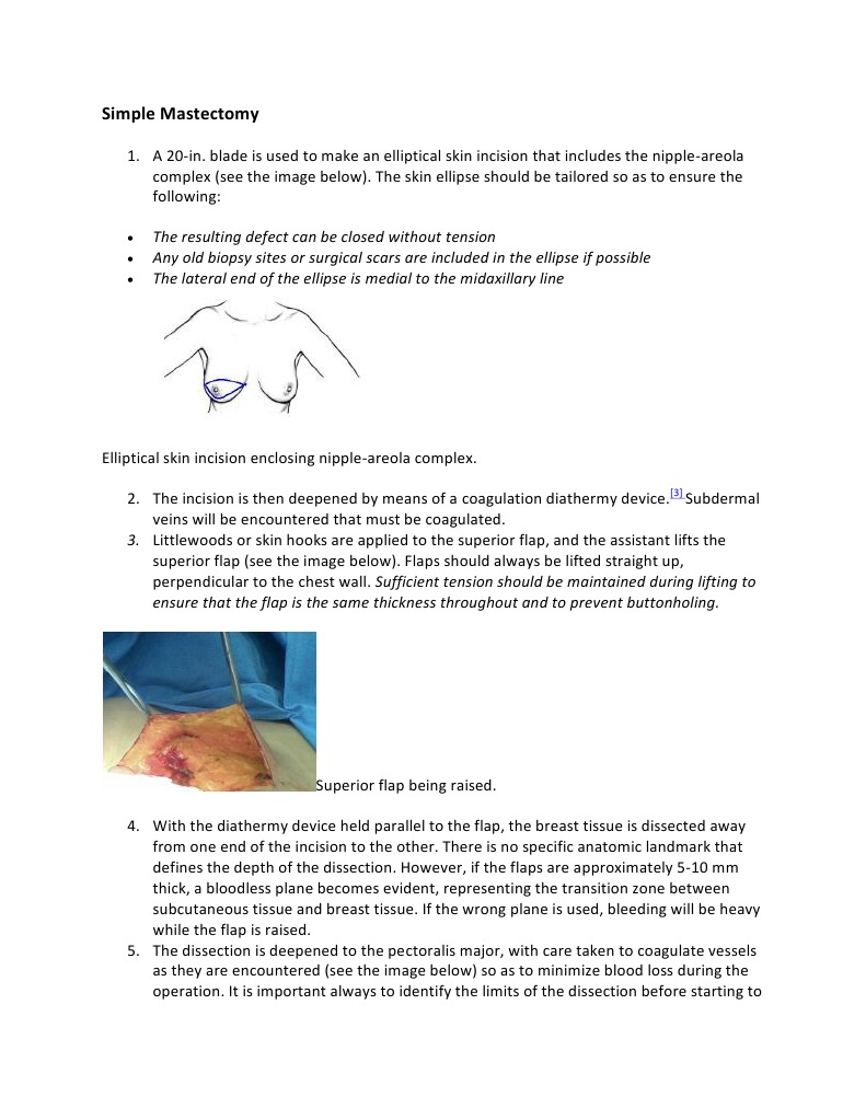 Simple Mastectomy | PDF | Breast | Surgical Suture