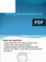 Iritis Dan Iridosiklitis