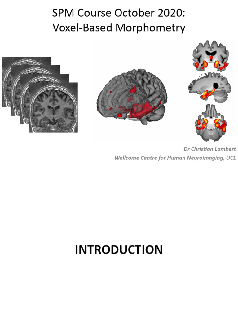 Voxel Based Morphometry | PDF