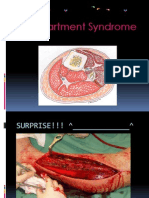 Compartment Syndrome