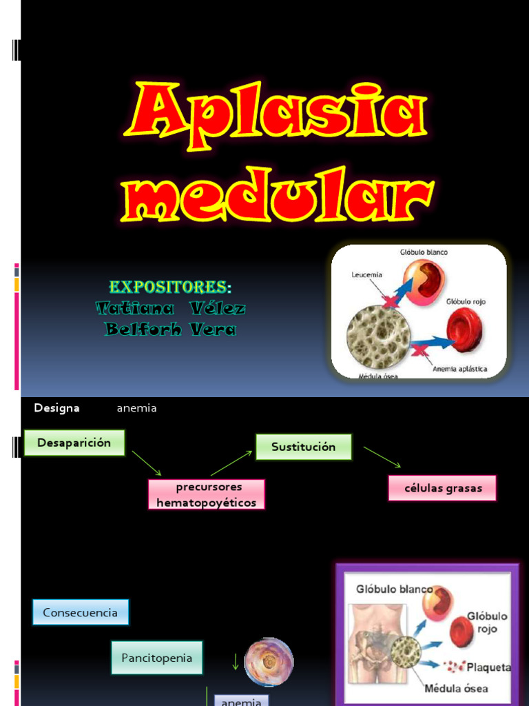 Aplasia Medular | PDF | Anemia | Especialidades Medicas