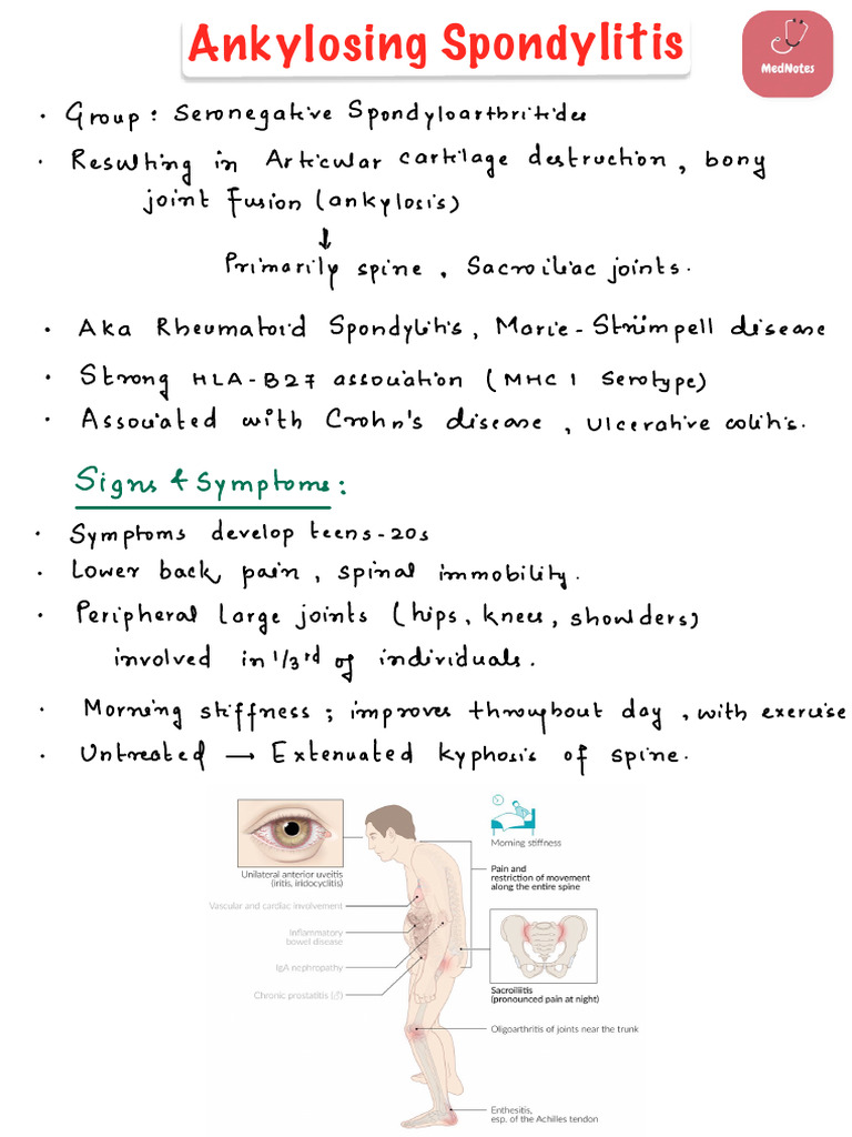 Ankylosing Spondylitis | PDF | Human Diseases And Disorders | Medicine