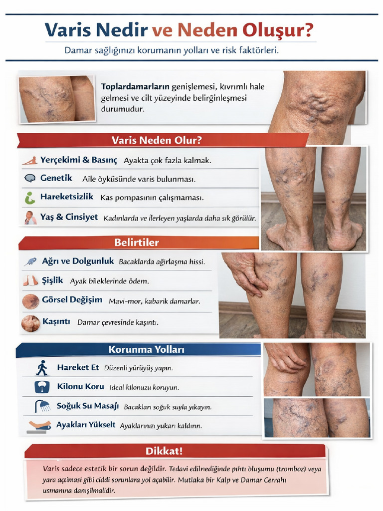 Varis İnfografik | PDF