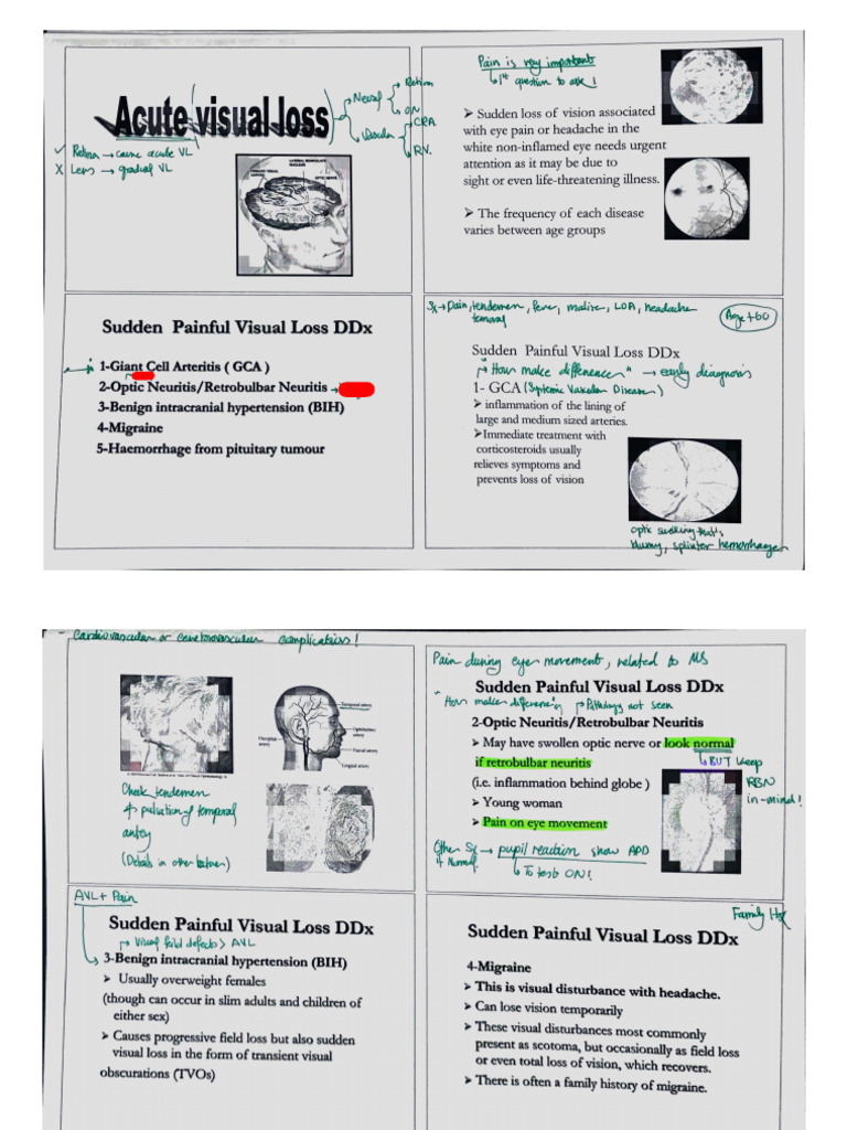 Sudden Visual Loss (My Notes) (5th Year) | PDF