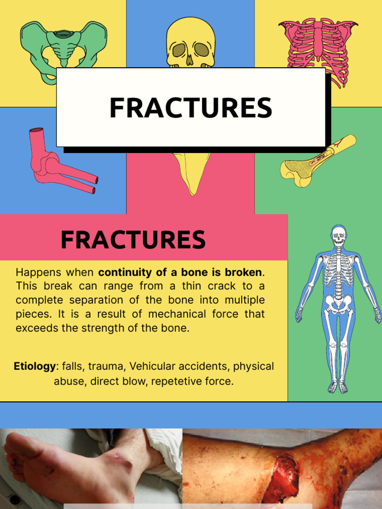 Fracture | PDF | Joint | Musculoskeletal System