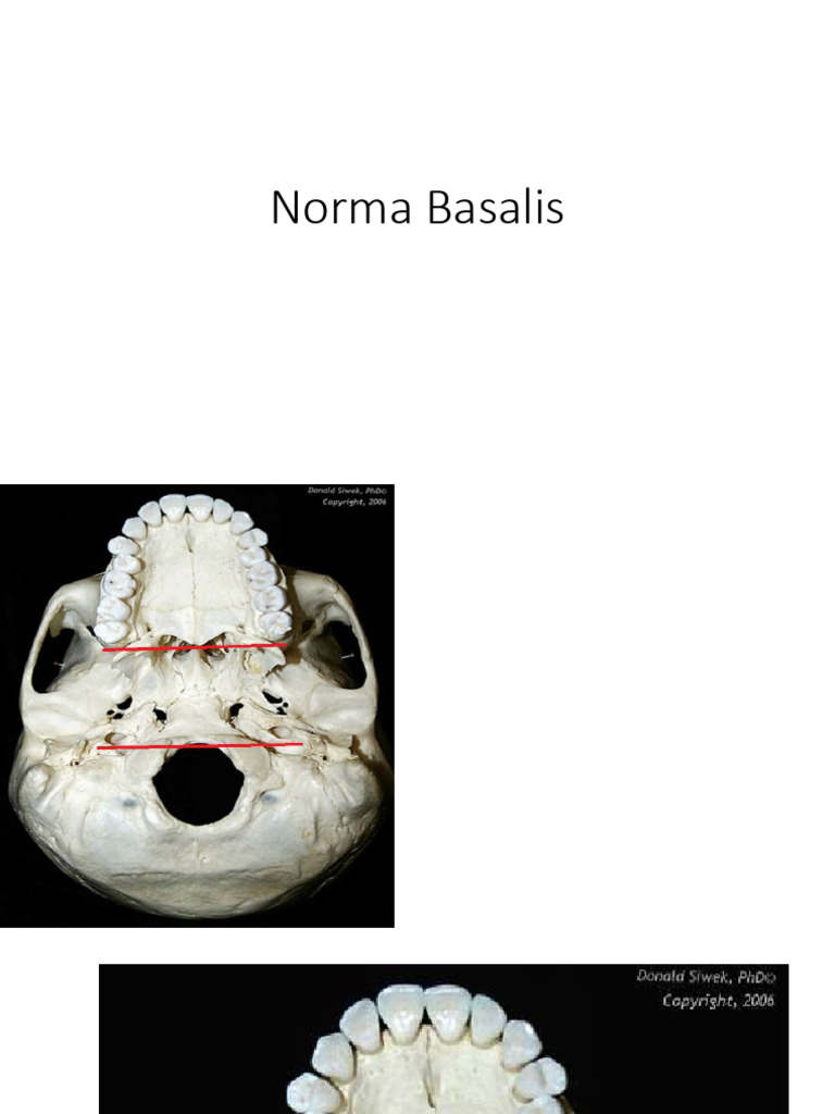 Norma Basalis-1 | PDF