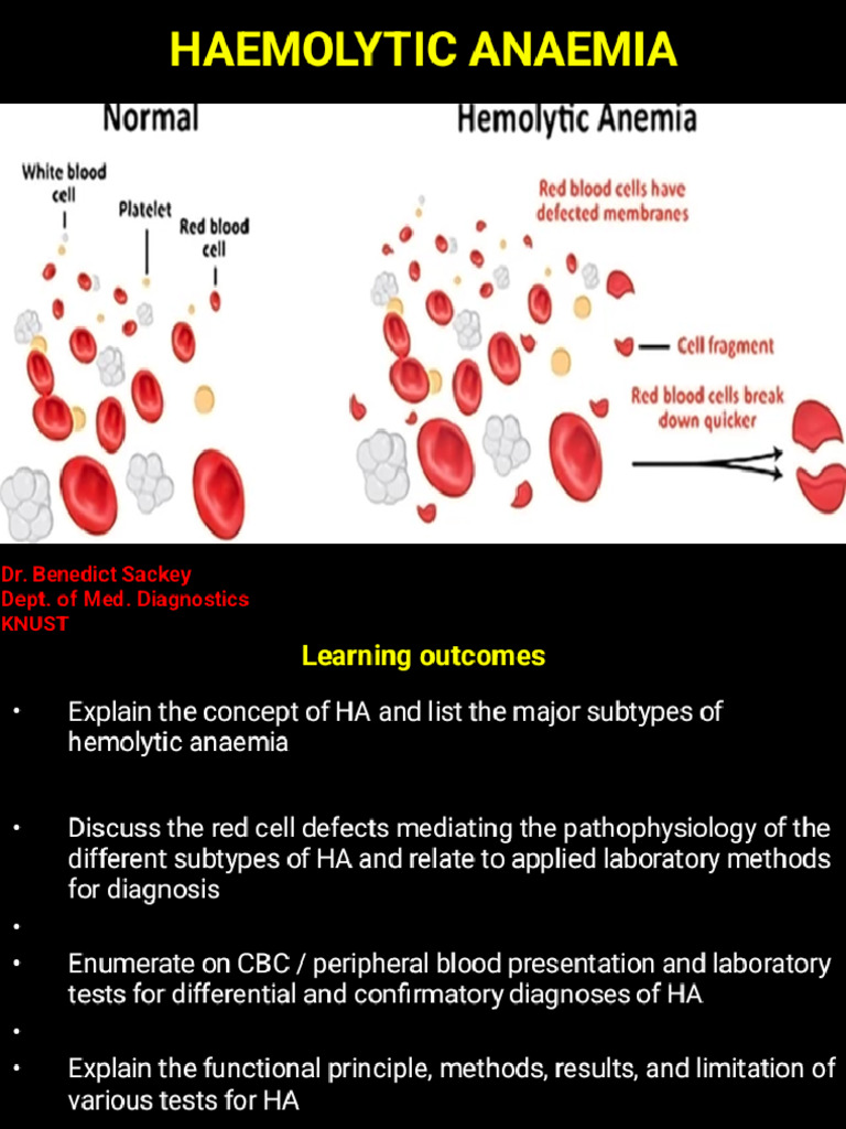 Haemolytic Anaemia Phoenix | PDF