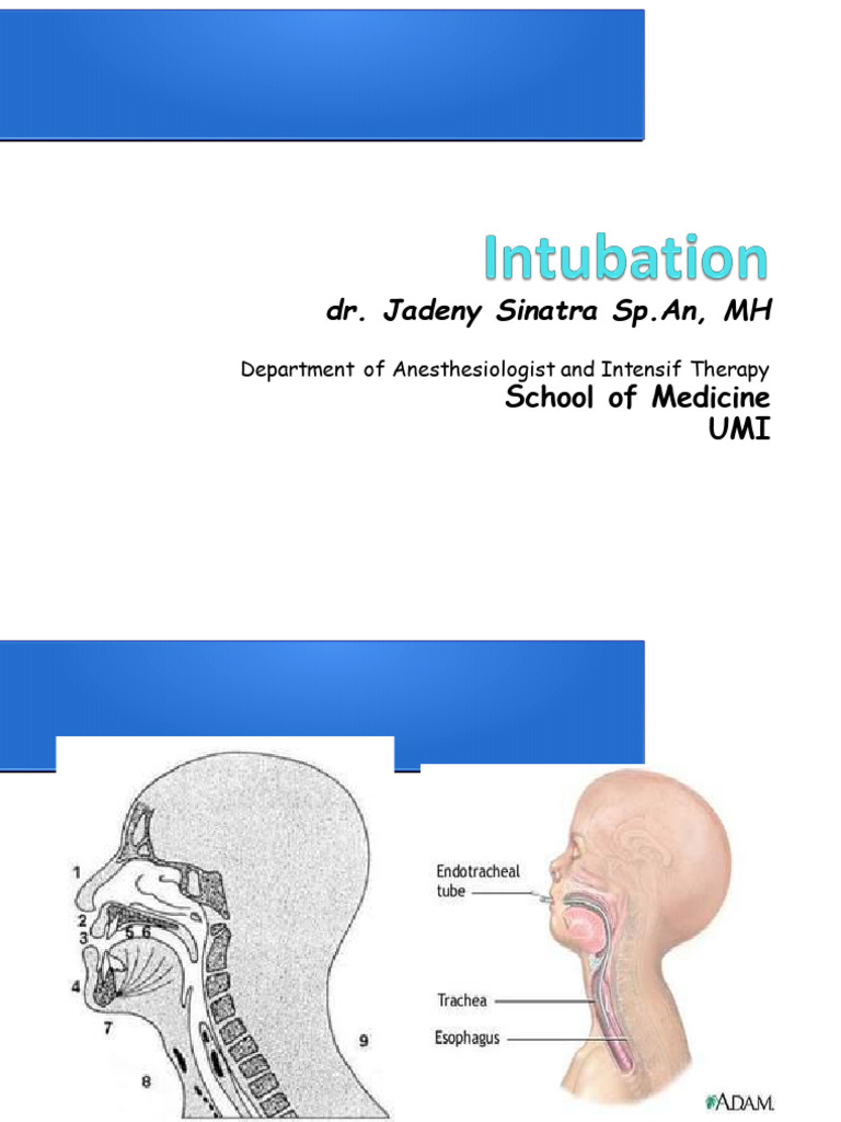 Intubation (Edit) | PDF