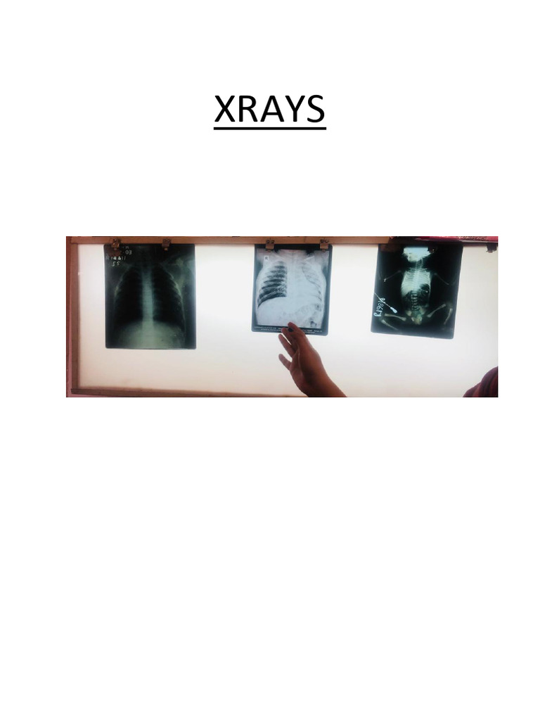 Xrays | PDF