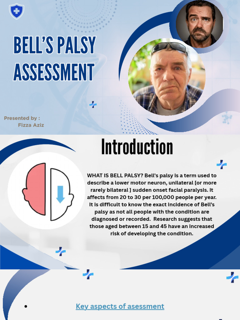 Bell's Palsy Assessment | PDF