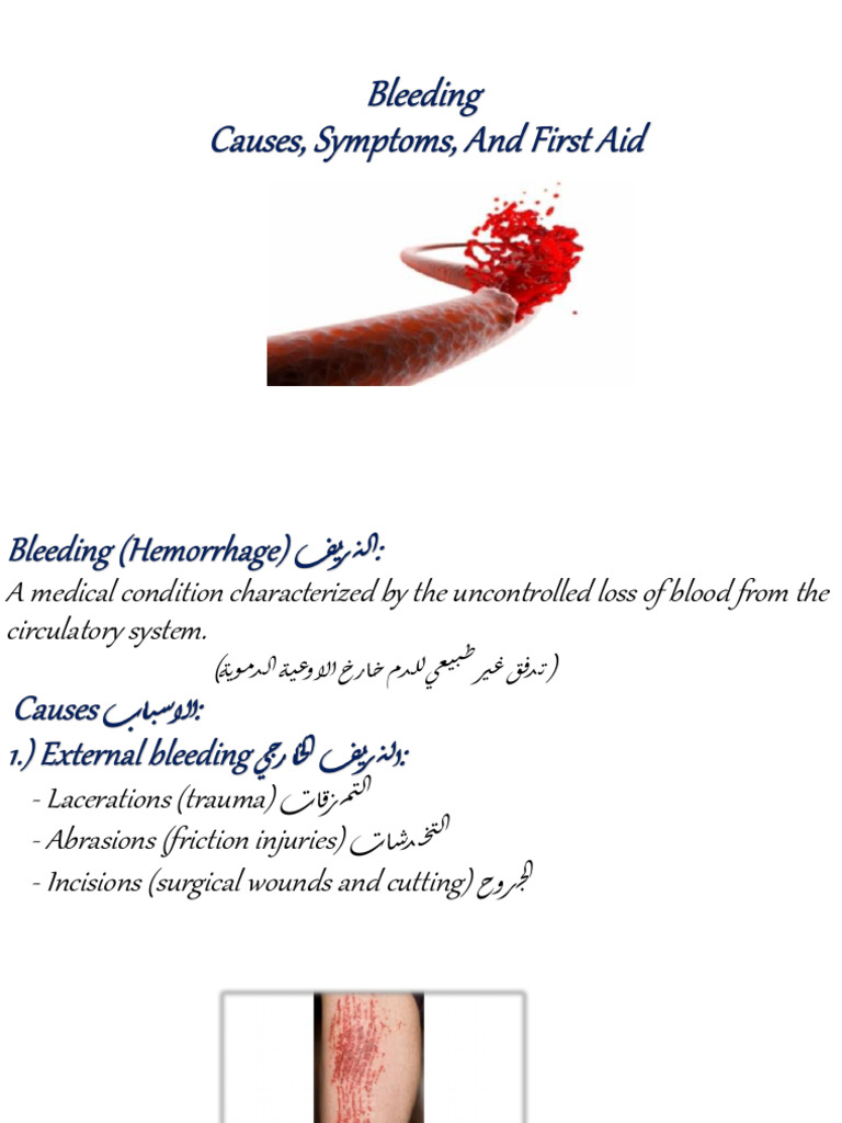 Bleeding F3 | PDF