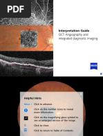 OCT Interpretation for Macula Diseases | PDF | Visual System | Diseases ...