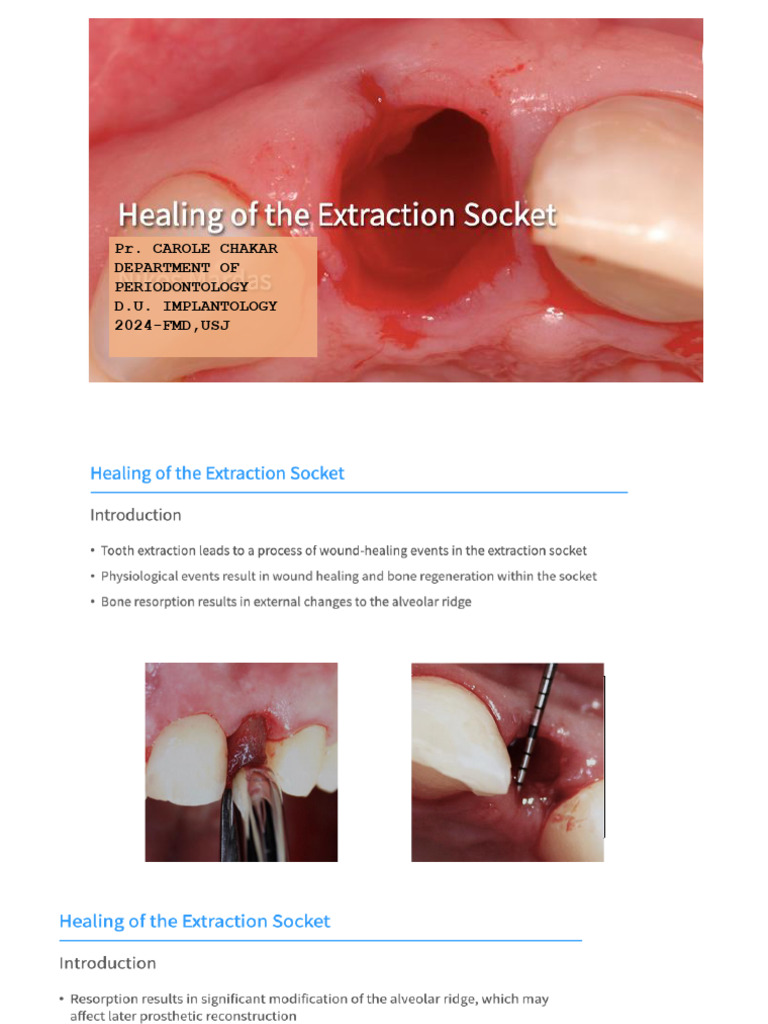 7 Healing of Extraction Socket DU IMPLANTO 2023 | PDF
