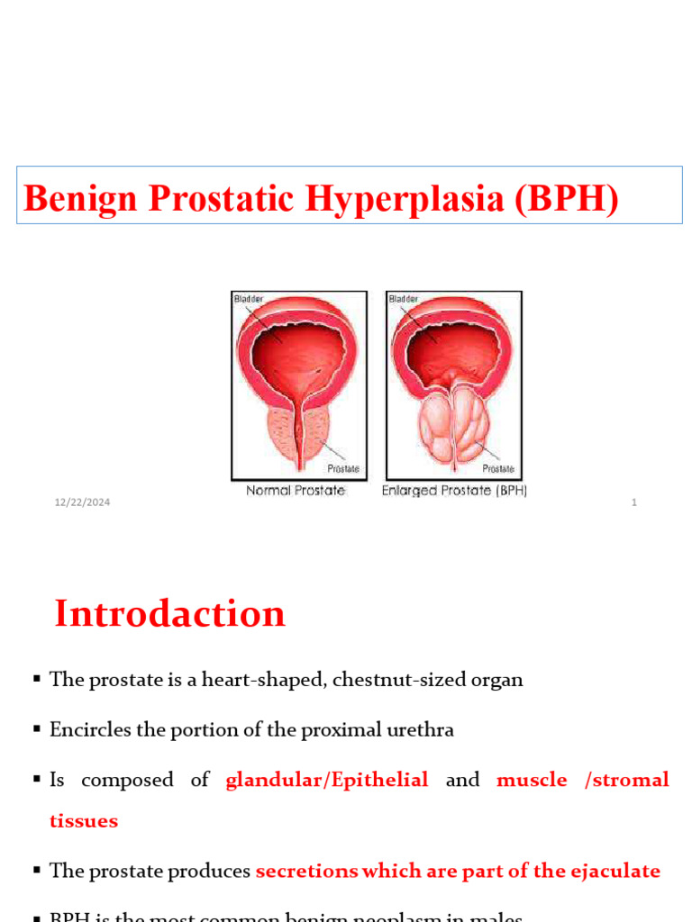Visual Reference: Benign Prostatic Hyperplasia Bph Pdf Urinary Incontinence