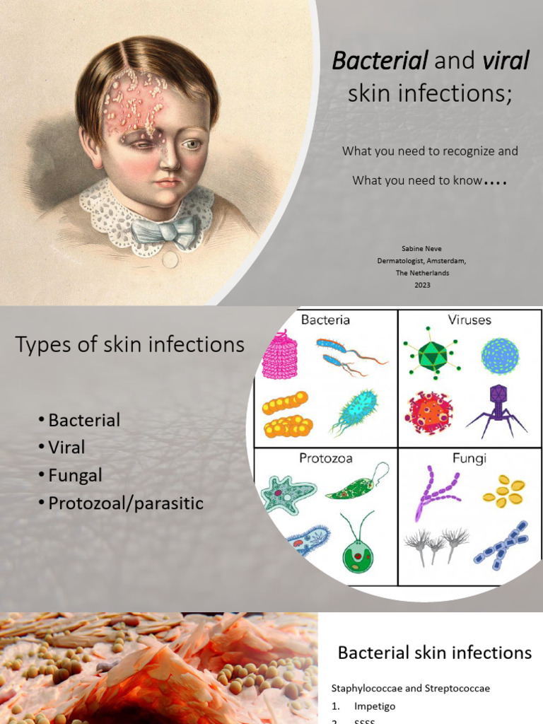 Bacterial and Viral Skin Infections | PDF