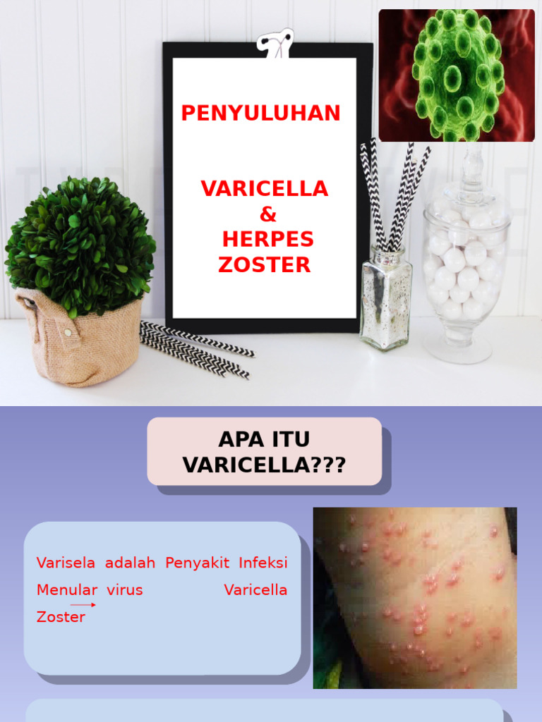 Penyuluhan Varicella Herpes Zoster | PDF