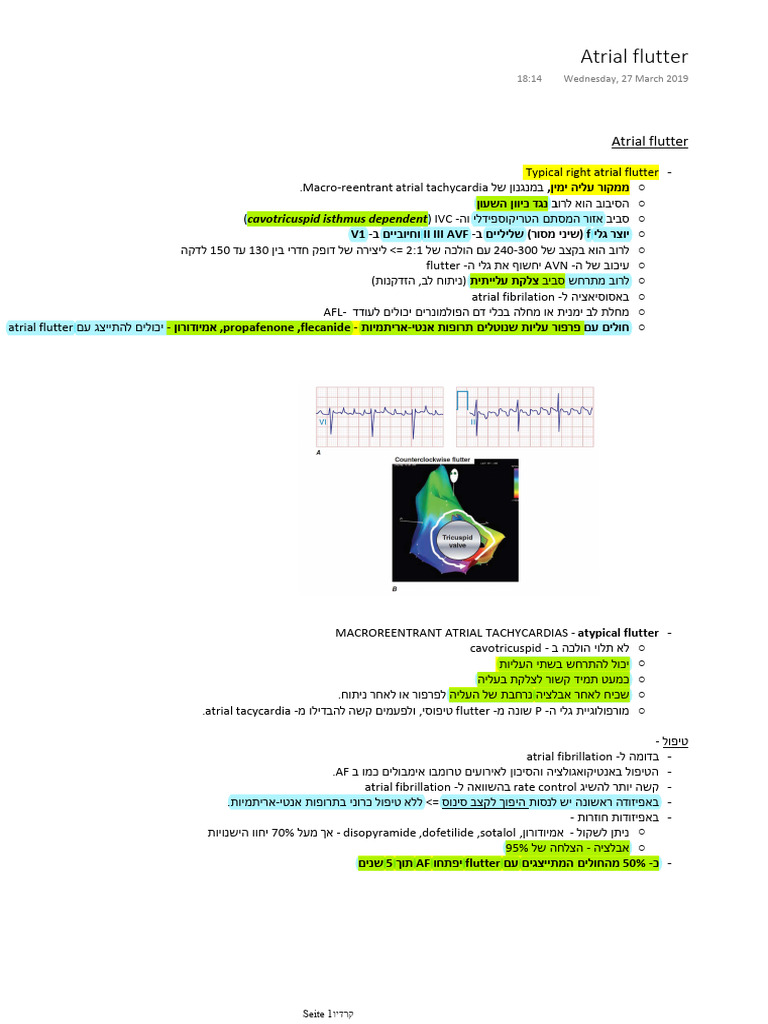 Atrial Flutter and Mat | PDF