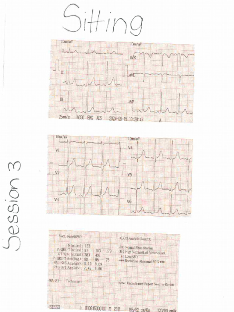 ECG Session 3 | PDF