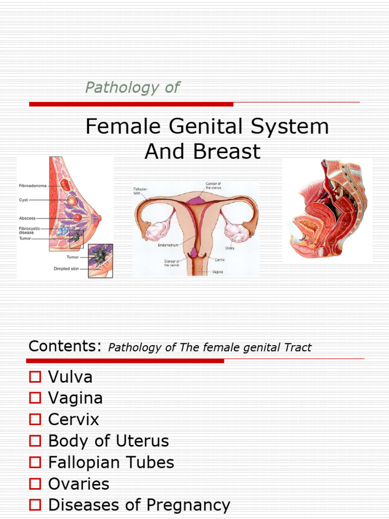 Pathology_of_the_female_genital_tract | PDF | Ovarian Cancer | Cervical ...