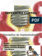 Implantes curtos: indicações e desempenho