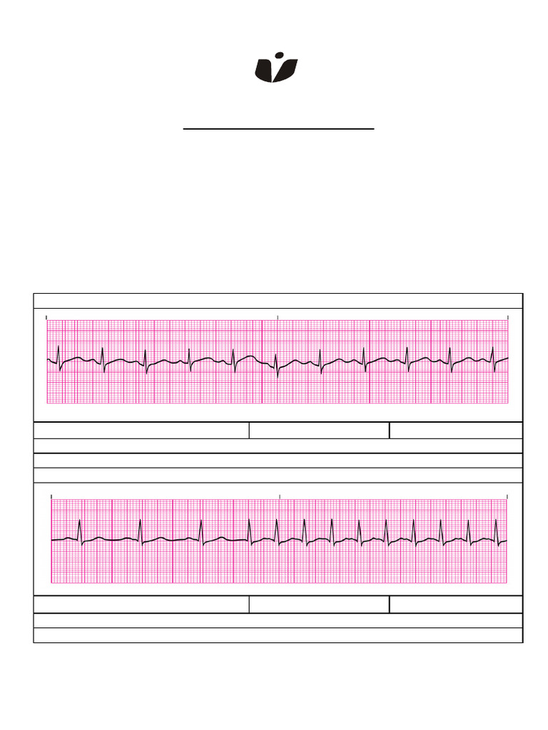 EKG Practice Strips NG | PDF