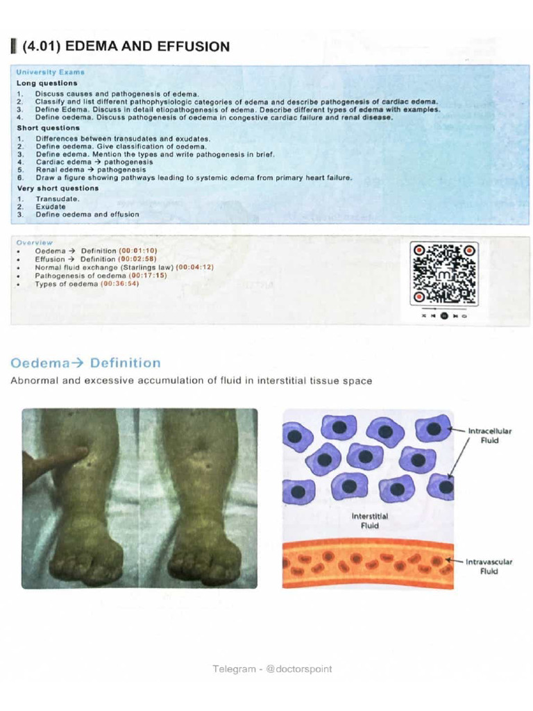 Edema #Deep | PDF