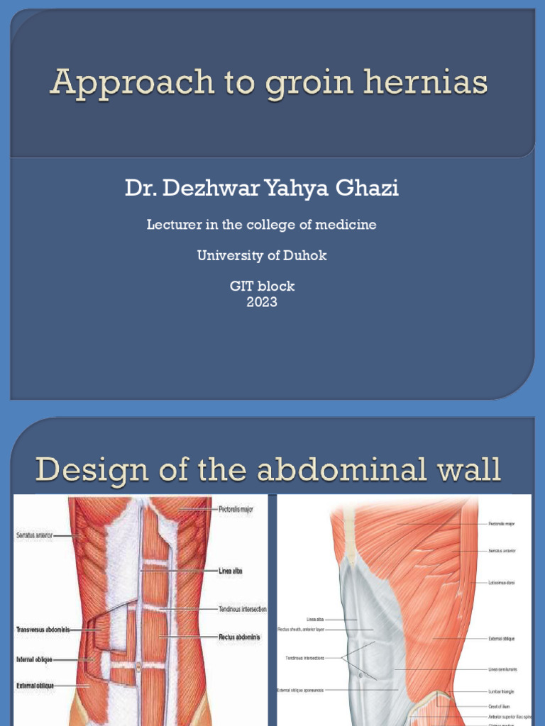 Appraoch To Groin Hernias | PDF | Abdomen