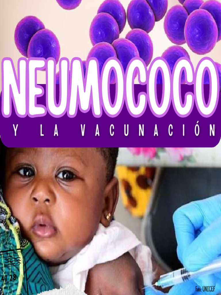 Neumococo Compressed Compressed | PDF | Meningitis | Microbiología