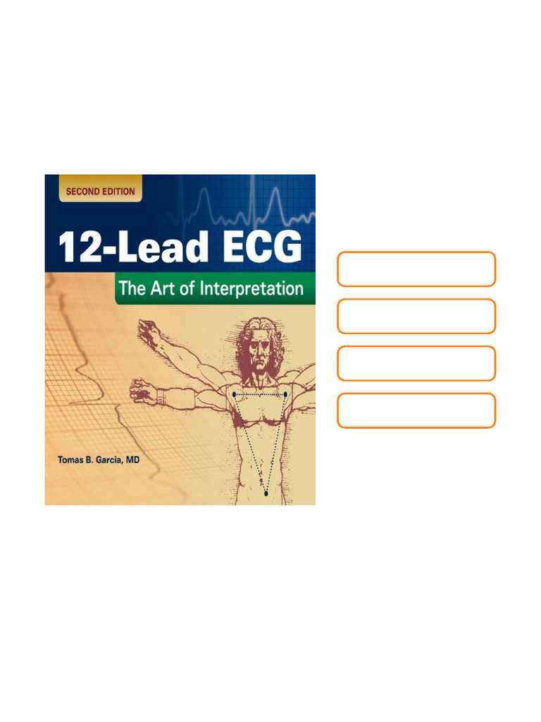 12 Lead ECG The Art of Interpretation 2nd Edition Available Full ...