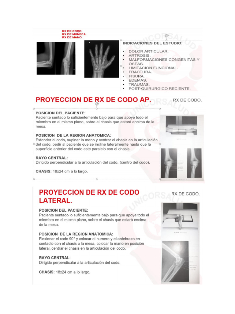 RX de Codo Reducida | PDF