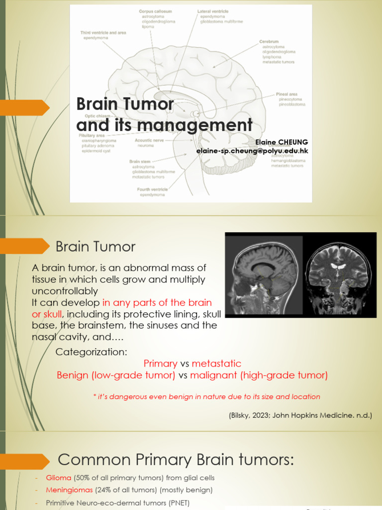 242_4_Brain Tumor and Its Management_std | PDF | Brain Tumor ...