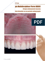 RePlant and RePlus With Nobelguide - DR Pena