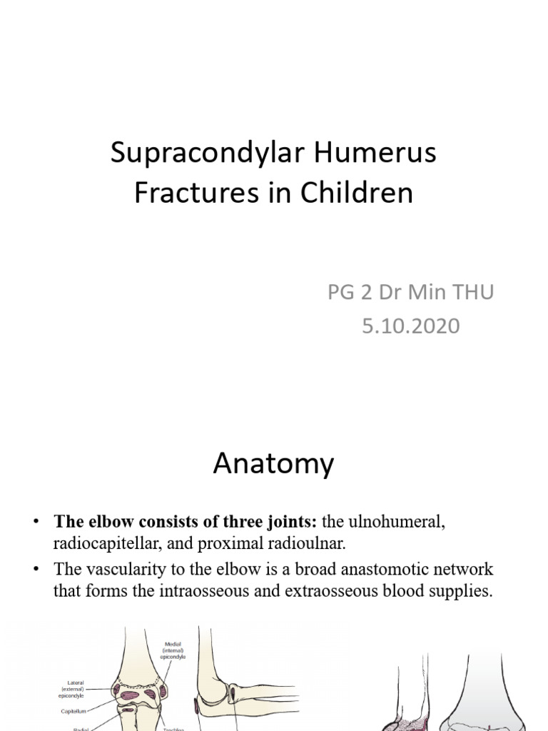 Supracondylar Humerus Fractures in Children | PDF