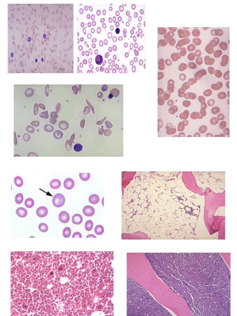Pathology Figure | PDF