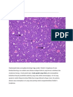 Pathology Assgmnt Burkitt's Lymphoma