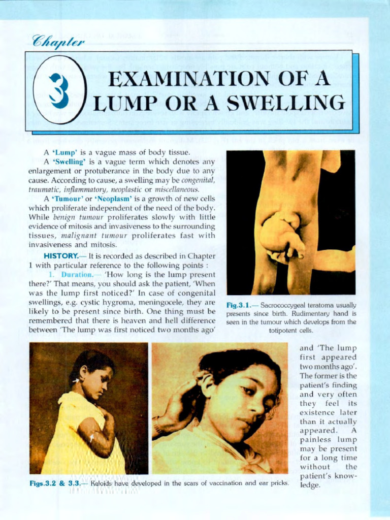 Lump_swelling Examination | PDF | Neoplasms | Benign Tumor
