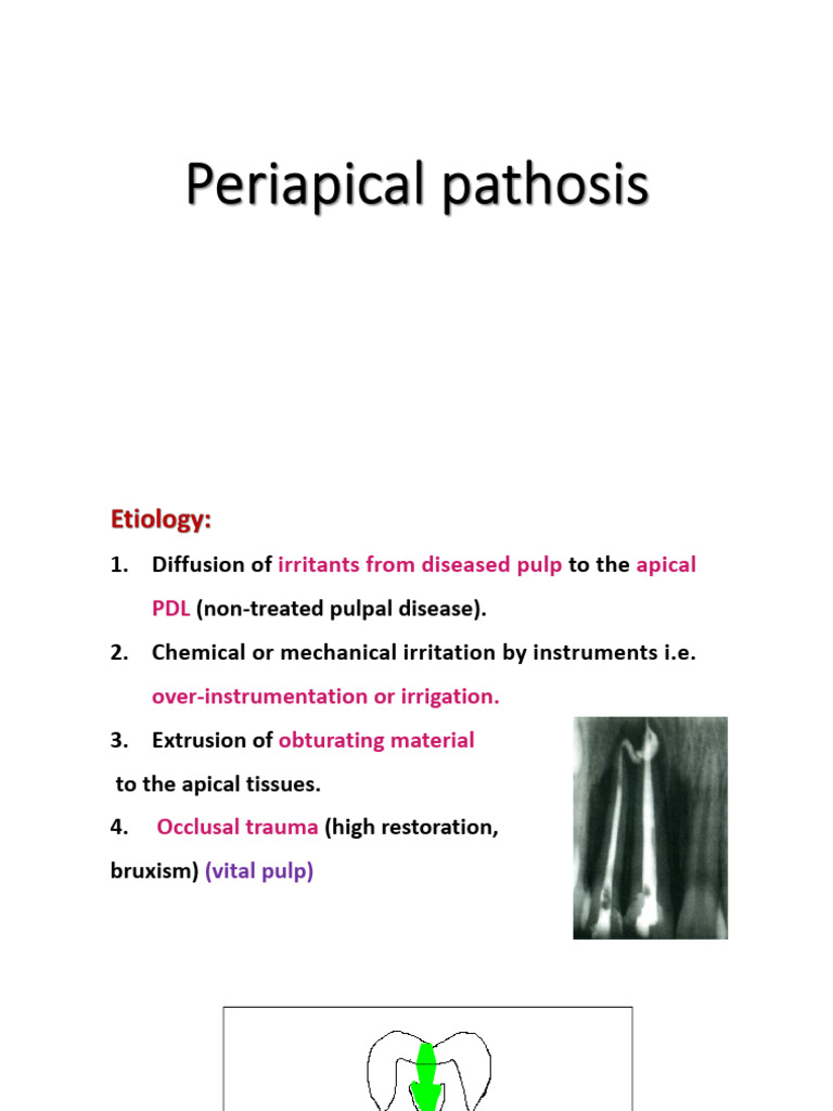 periapical pathosis (2) | PDF