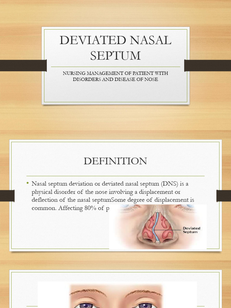 Deviated-nasal-septum (1) | PDF