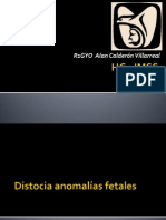 Distocia Anomalidad Fetal